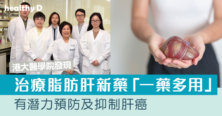 肝癌預防｜港大醫學院發現治療脂肪肝新藥「一藥多用」 有助預防及抑制肝癌