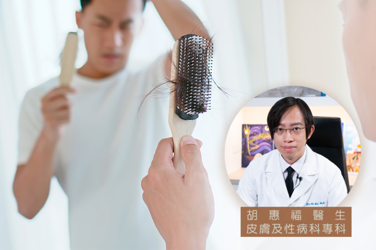 脫髮症狀-正常髮量-掉髮改善-最年輕脫髮病例僅16歲-生髮療程有用-皮膚科醫生破解掉髮治療迷思
