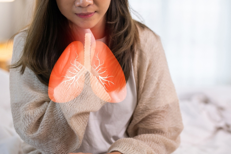 60多歲ALK肺癌患者錯失治療黃金期｜新藥改寫肺癌治療 醫患齊促關愛基金應覆蓋所有ALK肺癌患者