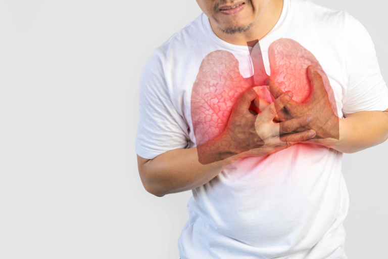 60多歲ALK肺癌患者錯失治療黃金期｜新藥改寫肺癌治療 醫患齊促關愛基金應覆蓋所有ALK肺癌患者