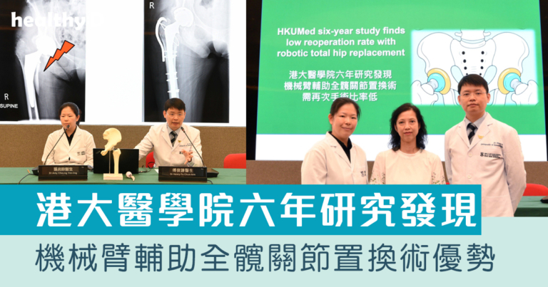 港大醫學院六年研究發現 機械臂輔助全髖關節置換術 需再次手術比率低