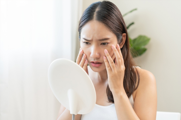 谷M生暗瘡便秘怎麼辦？中醫拆解經前綜合症症狀及改善食療推介