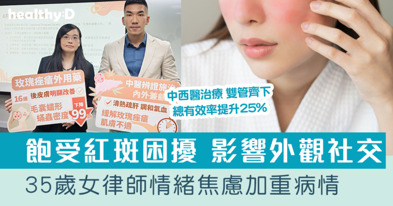 玫瑰痤瘡治療｜35歲女律師臉部飽受紅斑困擾 情緒焦慮加重病情｜西醫精準藥物+中醫辨證調養 助復發風險降逾七成