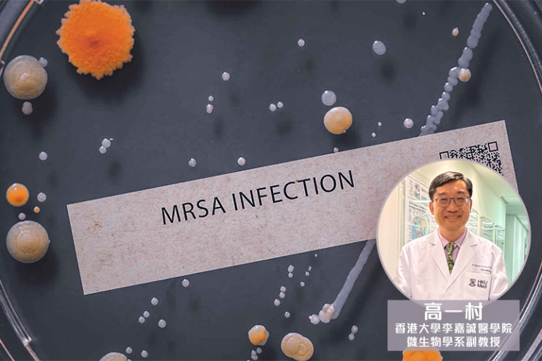 濕疹革命性突破-港大廿年科研-濕疹護理新配方-安思靈-打破耐藥性惡性循環-Anitch-高一村教授披露研究後續-冀五年後技術用於治療致命炎症