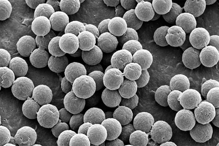 顯微鏡下的金黃葡萄球菌