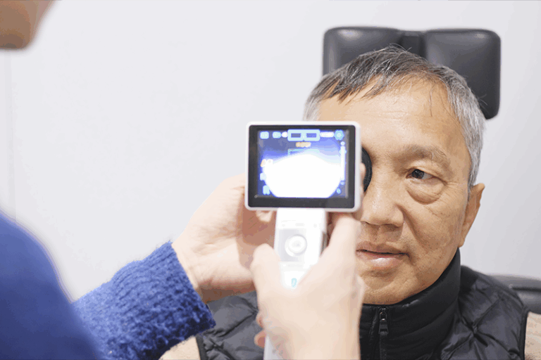 視網膜脫落手術2026 | 飛蚊突增、黑影遮擋要小心！視網膜脫落可致永久失明 | 清晰眼科引入新一代超微創手術平台同步處理白內障與眼底疾病 | 真實病例分享：康復理想