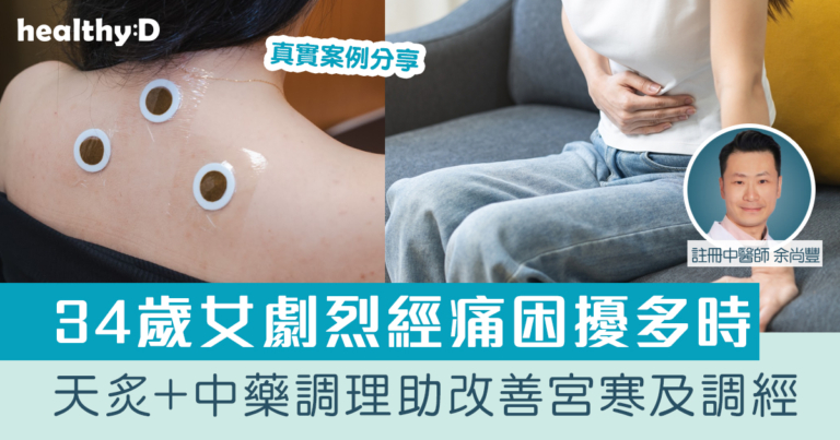嚴重生理痛真實案例｜34歲女劇烈經痛困擾多時 天炙+中藥調理助改善宮寒及調經