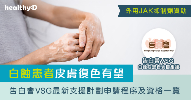 JAK抑制劑資助｜白蝕症Vitiligo患者支援組織：告白會VSG 及最新支援計劃申請程序及資格一覽