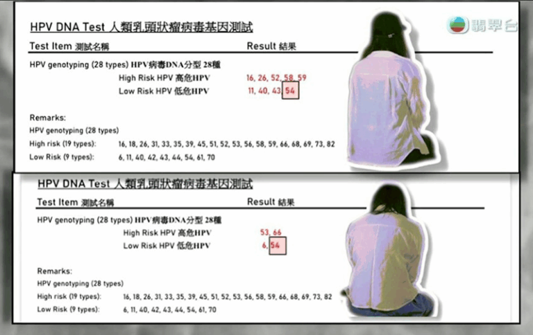 東張西望｜染HPV渣男播毒 醫生：感染十年內仍可傳播 目前無藥可醫