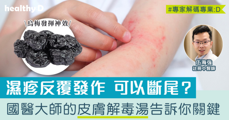 濕疹斷尾？國醫大師的「皮膚解毒湯」告訴你關鍵