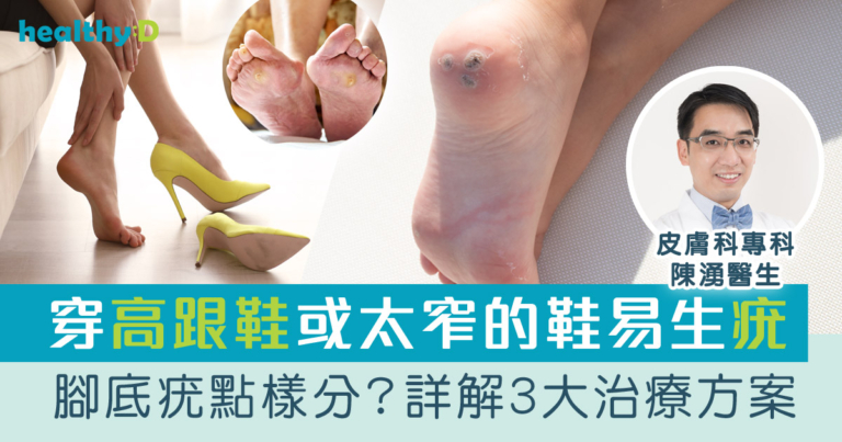 疣/雞眼/腳繭 | 醫生教你分辨腳底疣症狀！治療疣3大方法