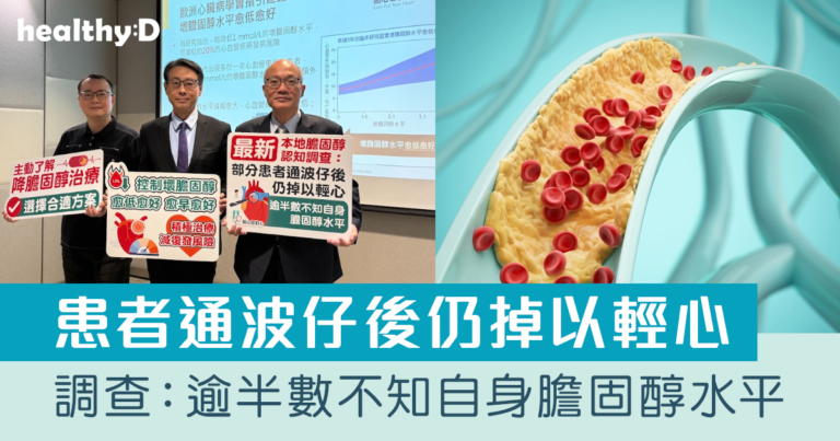 調查：患者通波仔後仍掉以輕心 逾半數不知自身膽固醇水平 醫生提醒壞膽固醇控制愈低愈好  愈早愈好