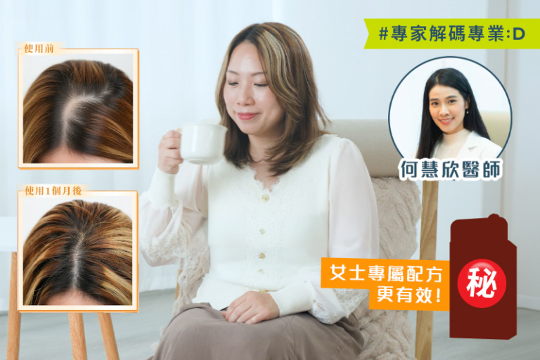 防掉髮保健品分性別更有效？即睇3個真實個案及中醫分析：選女士專用天然配方 逆轉秀髮更豐盈年輕