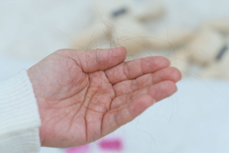 防掉髮保健品分性別更有效？即睇3個真實個案及中醫分析：選女士專用天然配方 逆轉秀髮更豐盈年輕