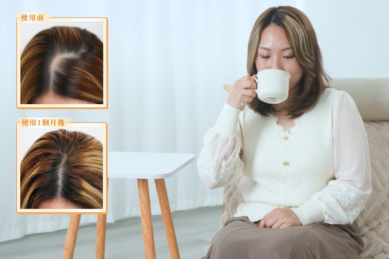 防掉髮保健品分性別更有效？即睇3個真實個案及中醫分析：選女士專用天然配方 逆轉秀髮更豐盈年輕