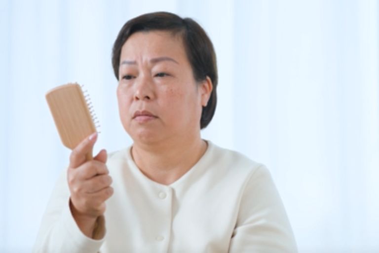 防掉髮保健品分性別更有效？即睇3個真實個案及中醫分析：選女士專用天然配方 逆轉秀髮更豐盈年輕