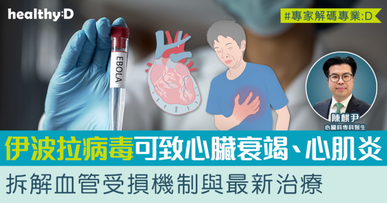 惜心談心#19｜伊波拉病毒可致心臟衰竭及心肌炎！心臟科專科醫生拆解血管受損機制與最新治療