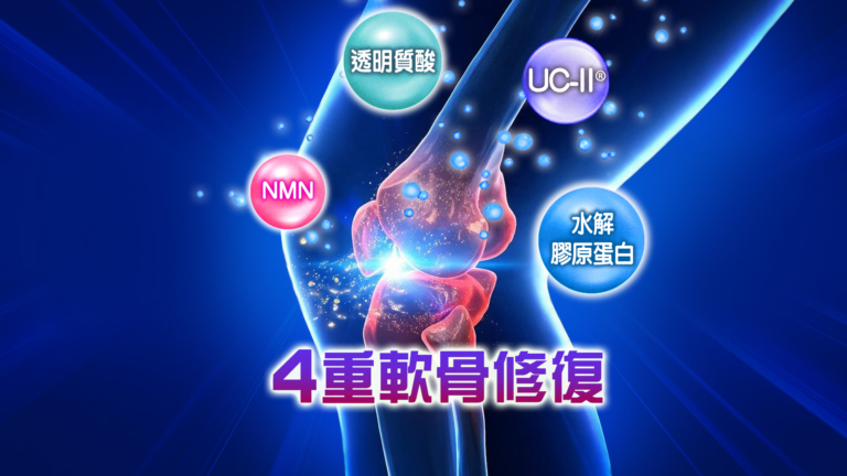 關節構造及關節痛的原因
