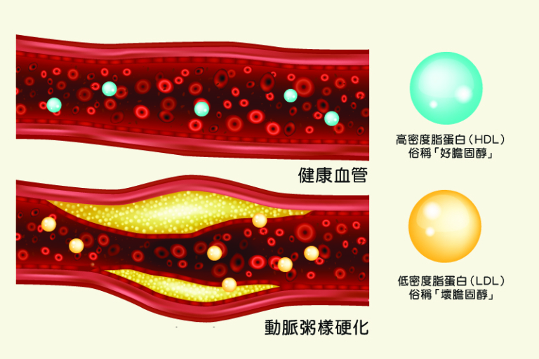 脂蛋白a Lipoprotein (a) 是什麼？Lp(a)正常值及藥物治療方法比較