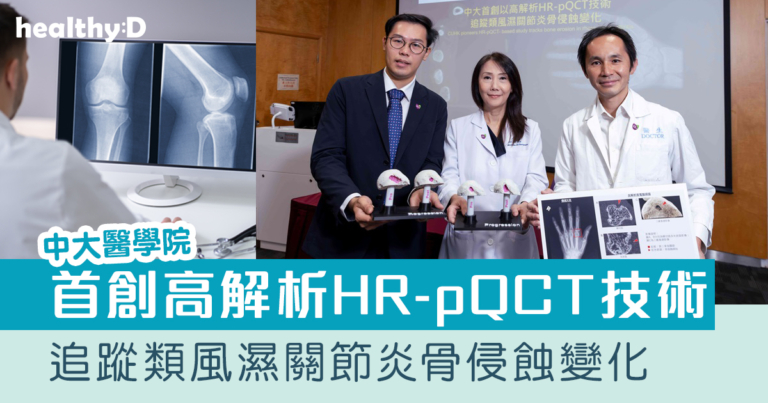 中大首創高解析HR-pQCT技術追蹤類風濕關節炎骨侵蝕變化 準確分辨微小真正病變   倡早診早治逆轉關節損傷