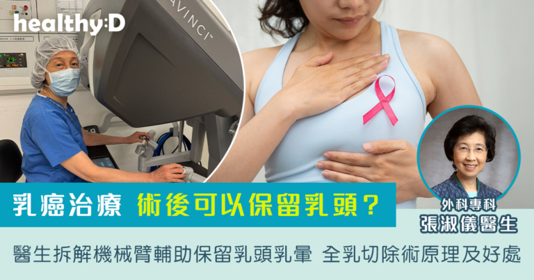 乳癌治療｜術後可以保留乳頭？醫生拆解機械臂輔助保留乳頭乳暈全乳切除術原理及好處