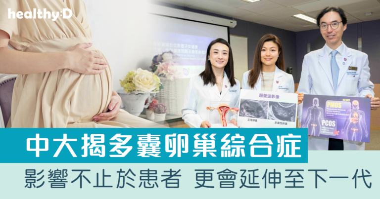 中大揭多囊卵巢綜合症跨代健康影響 女兒易出現生殖問題 兒子增心血管代謝風險