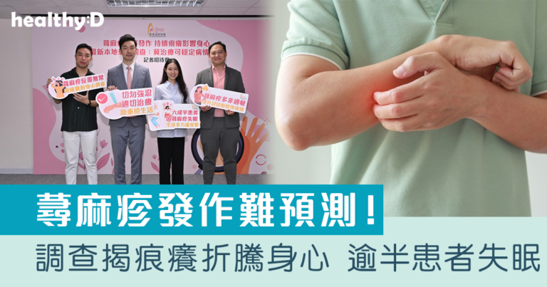 蕁麻疹發作難預測！調查揭痕癢折騰身心逾半患者失眠｜醫生提醒積極治療助病情穩控
