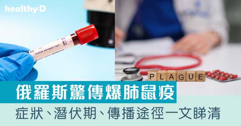 鼠疫是甚麼？肺鼠疫症狀、潛伏期、傳播途徑、致命率一文睇清